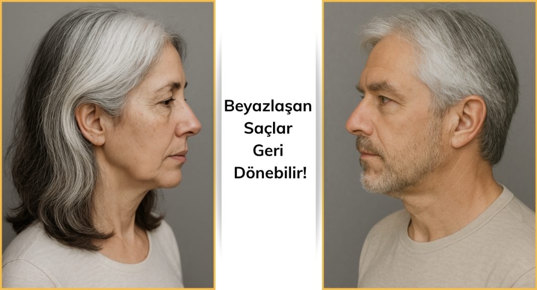 Beyazlaşan Saçlar