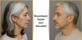 Stres Röfleleri Olarak Adlandırılan Beyazlaşan Saçlar Geri Dönebilir! Beyazlaşan Saçlar